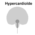 Hypercardioïde